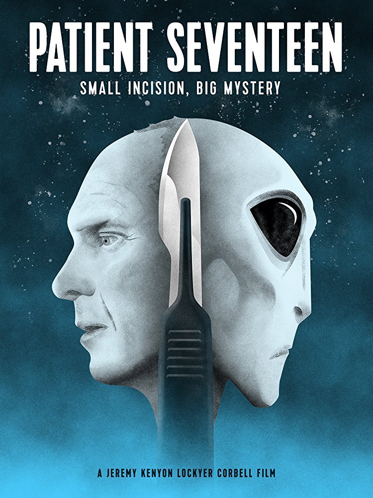 Фильм Пациент номер семнадцать (2017)